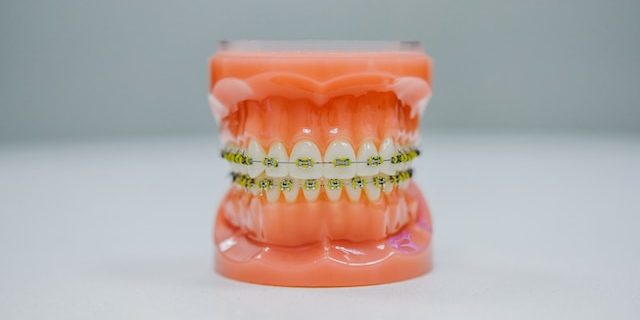 pasang behel dokter gigi